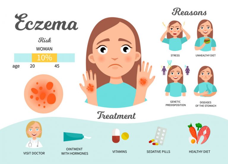 Psoriasis Vs Eczema: Let's Understand The Difference