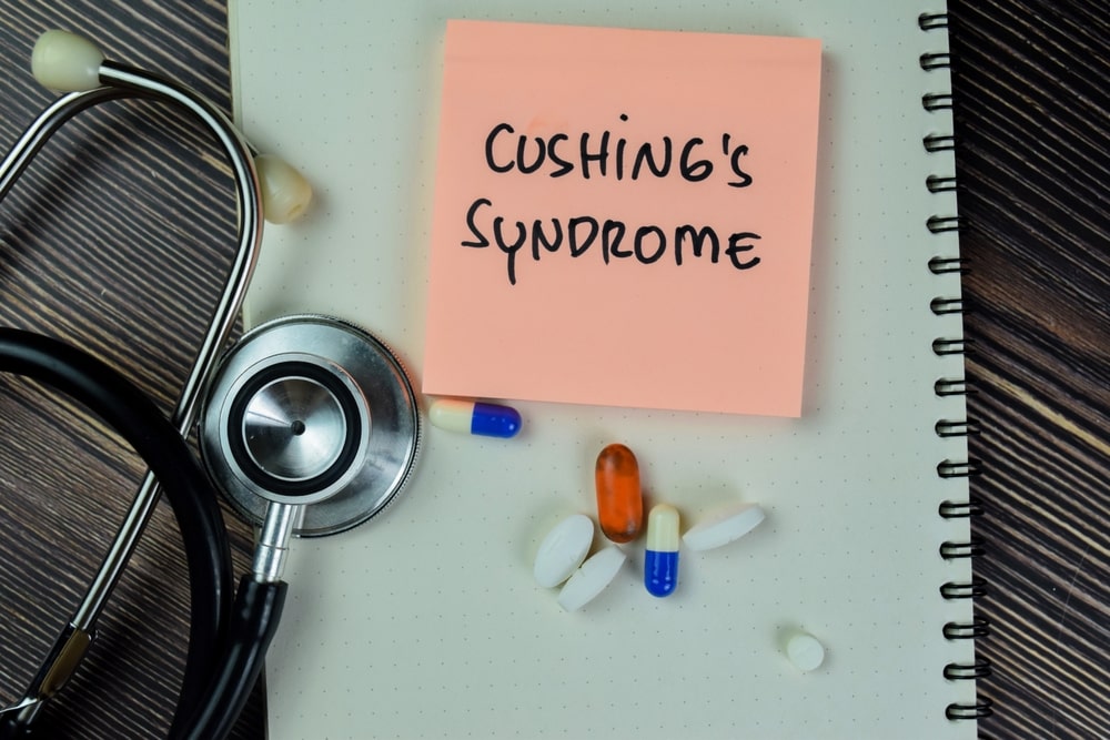 is-cushing-syndrome-fatal-find-out-more