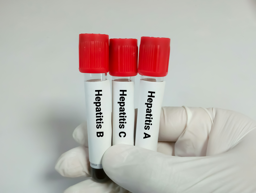 Types of Hepatitis A, B, C